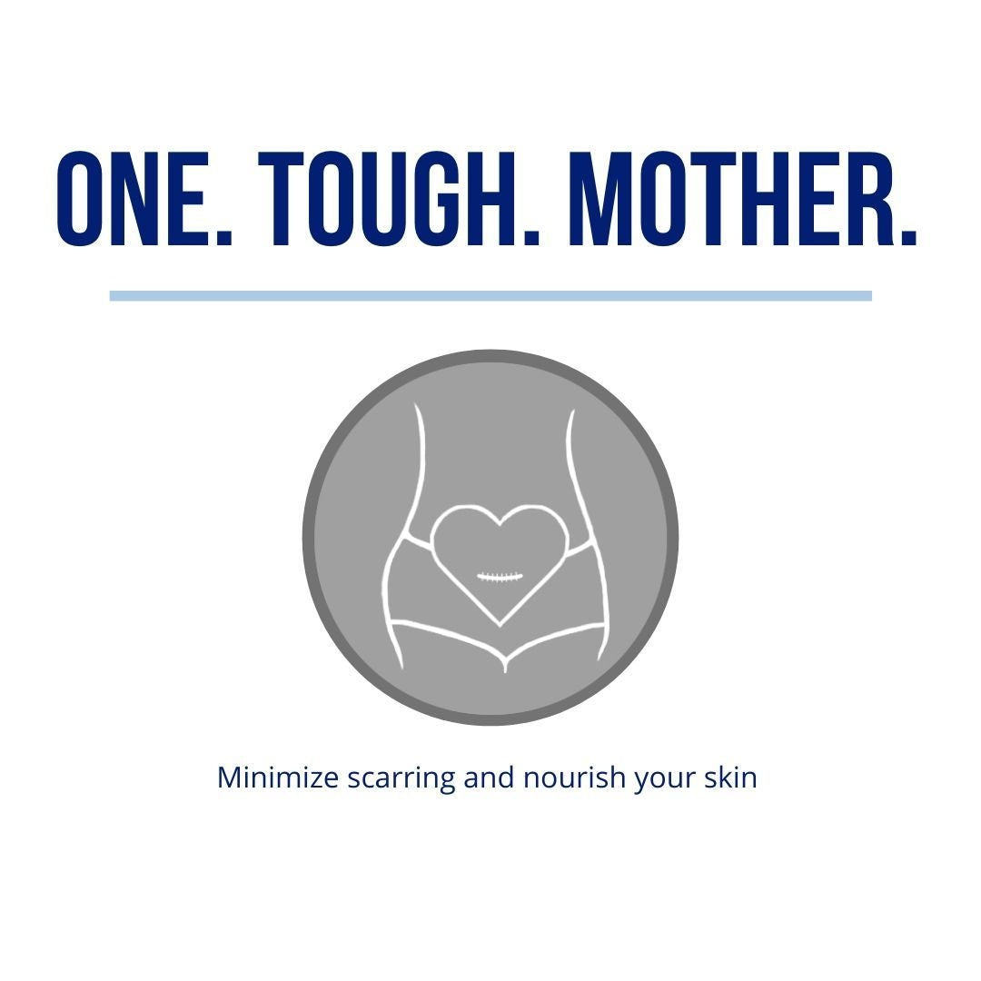 Motherlove C-Section Cream - 1 oz